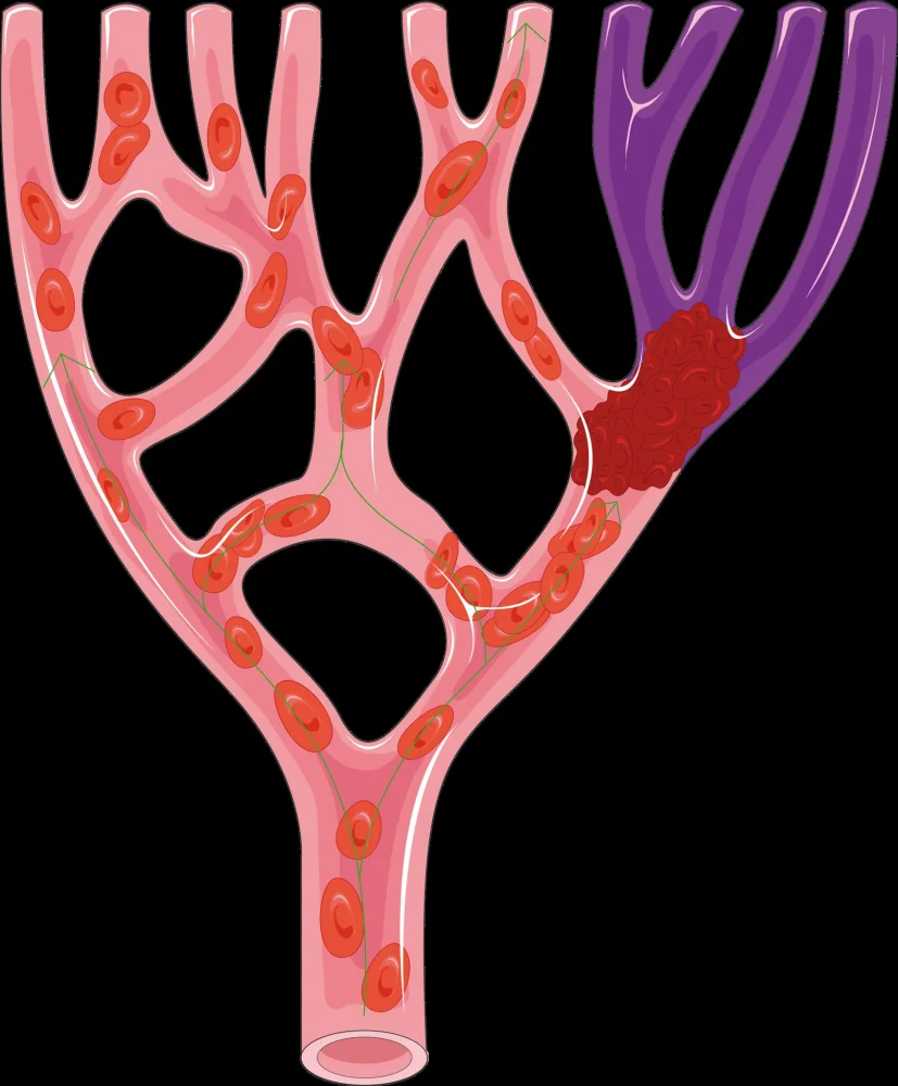 Actilyse and Actilyse Cathflo